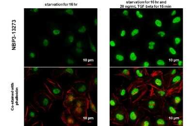 Immunocytochemistry/ Immunofluorescence: Smad2 [p Ser465, p Ser467] Antibody [NBP3-13273]